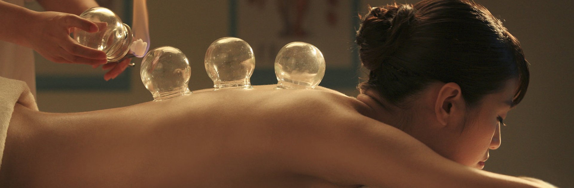 Cupping & Guasha